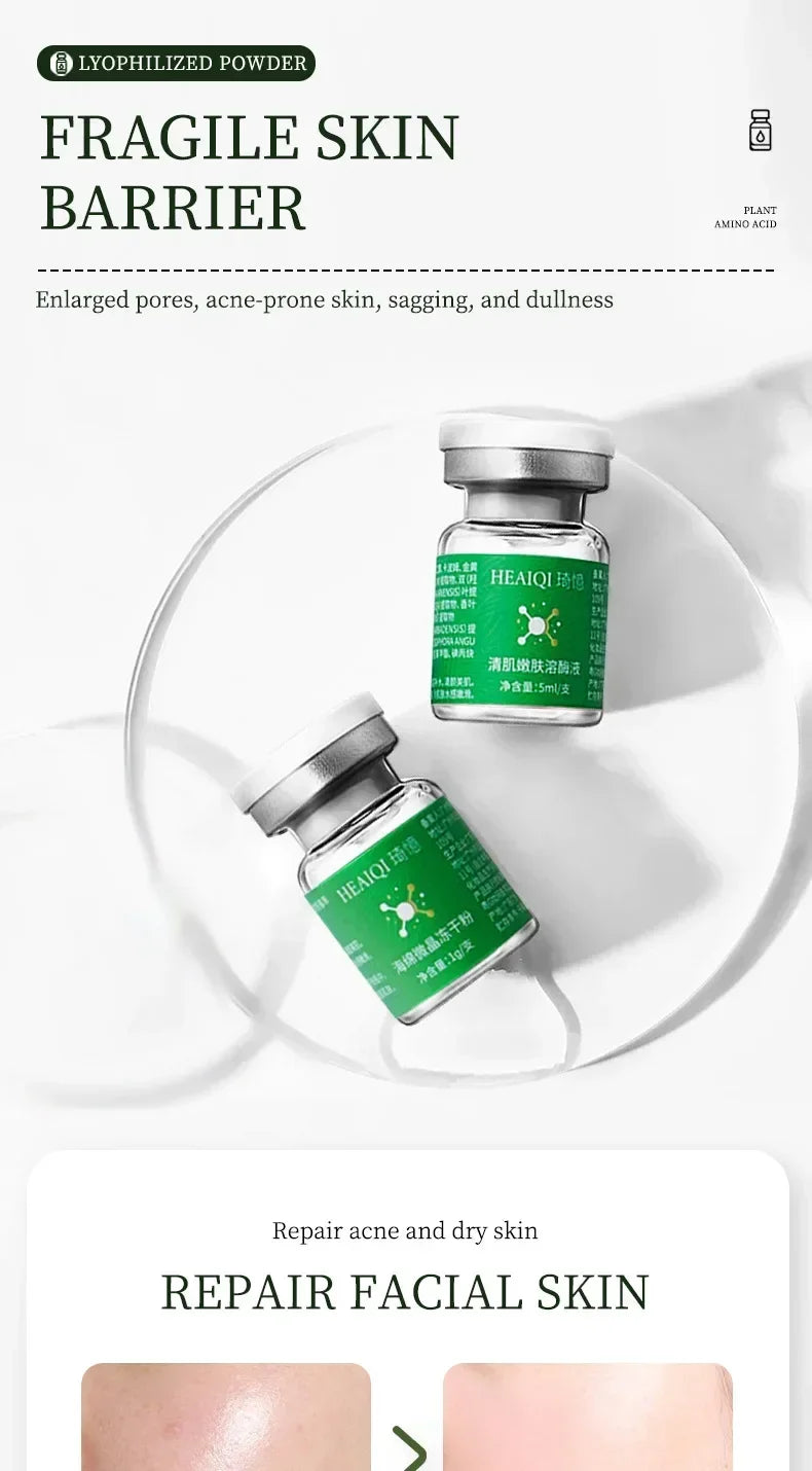 Masque Facial pour enlever les points noirs